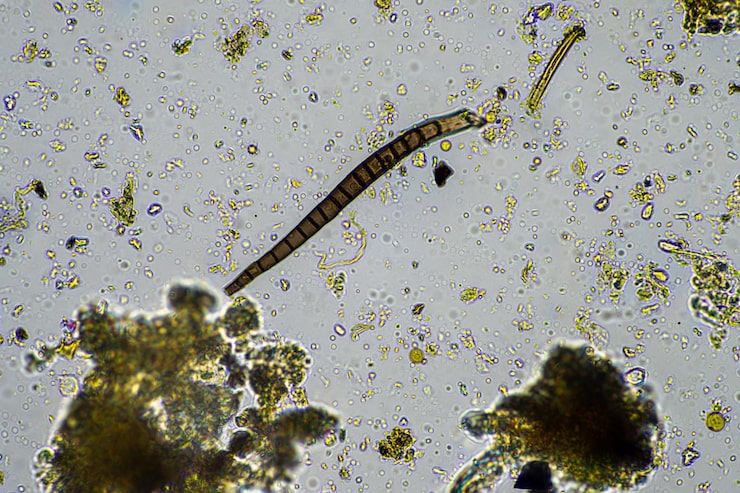 pasożyty i toksyny a biorezonans futuramedica