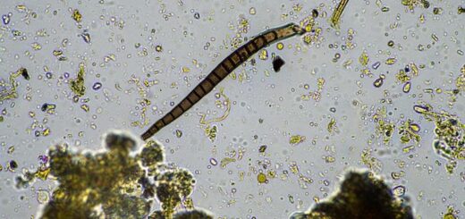 pasożyty i toksyny a biorezonans futuramedica